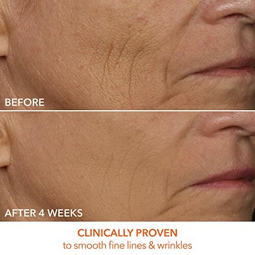 Comparison of skin appearance before and after using a product for 4 weeks, showing reduced fine lines and wrinkles.