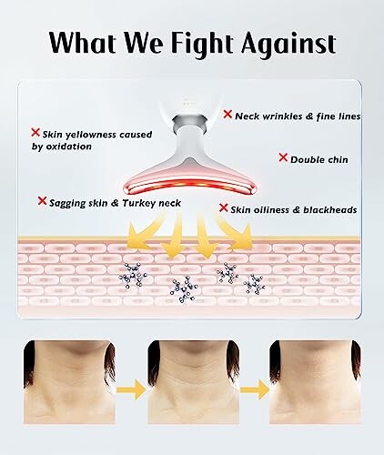 Diagram showing skin issues targeted by a skincare device, including wrinkles, double chin, and blackheads.